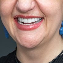 Slider image (7) Turkiye Dental